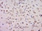 PTPRS Polyclonal Antibody